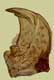 Mandible